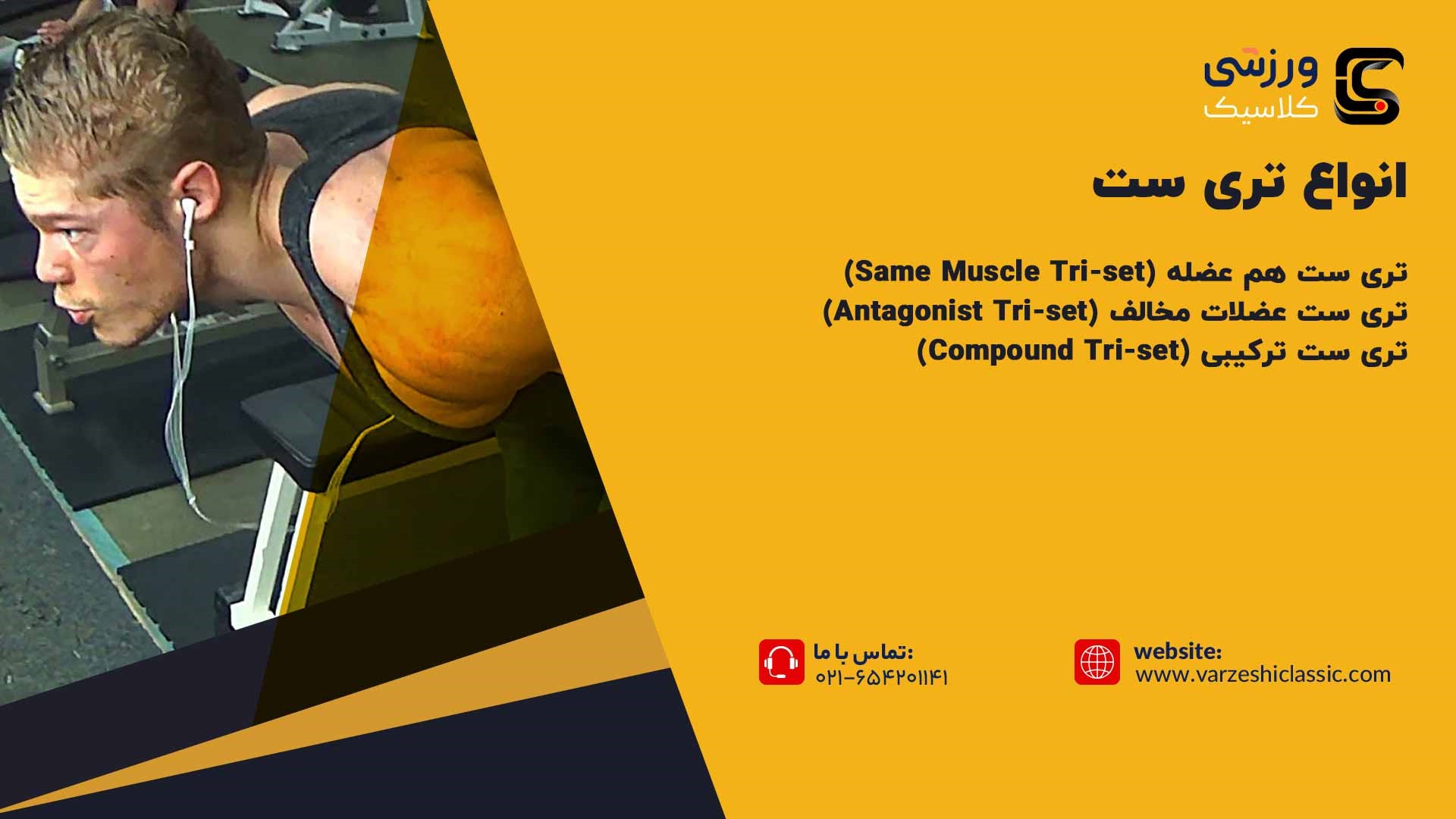 انواع تری ست